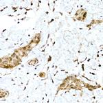 Nrf2 Antibody in Immunohistochemistry (Paraffin) (IHC (P))