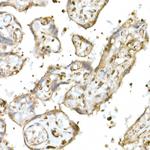 Nrf2 Antibody in Immunohistochemistry (Paraffin) (IHC (P))