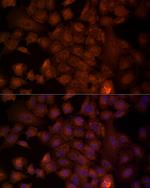 NRG1 Antibody in Immunocytochemistry (ICC/IF)