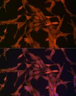 NRG1 Antibody in Immunocytochemistry (ICC/IF)