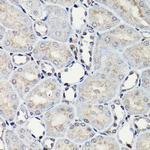 C/EBP beta Antibody in Immunohistochemistry (Paraffin) (IHC (P))