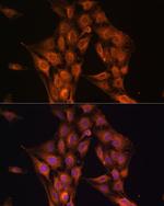 NF2 Antibody in Immunocytochemistry (ICC/IF)