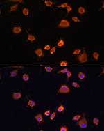 NF2 Antibody in Immunocytochemistry (ICC/IF)