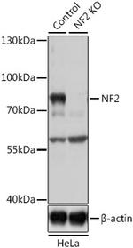 NF2 Antibody in Western Blot (WB)