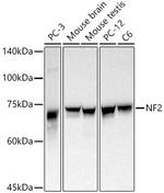 NF2 Antibody in Western Blot (WB)