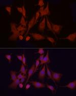 APAF1 Antibody in Immunocytochemistry (ICC/IF)