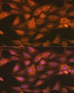 IKK gamma Antibody in Immunocytochemistry (ICC/IF)