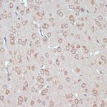 YAP1 Antibody in Immunohistochemistry (Paraffin) (IHC (P))