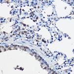 SRC2 Antibody in Immunohistochemistry (Paraffin) (IHC (P))