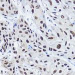 SRC2 Antibody in Immunohistochemistry (Paraffin) (IHC (P))