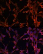 UBE2G2 Antibody in Immunocytochemistry (ICC/IF)