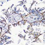 MMP16 Antibody in Immunohistochemistry (Paraffin) (IHC (P))