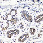 MMP16 Antibody in Immunohistochemistry (Paraffin) (IHC (P))