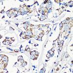 MMP16 Antibody in Immunohistochemistry (Paraffin) (IHC (P))