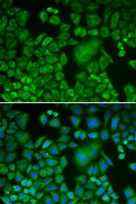 Arp3 Antibody in Immunocytochemistry (ICC/IF)