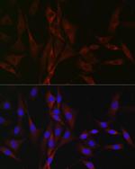 CaV3.2 Antibody in Immunocytochemistry (ICC/IF)