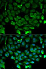 Cullin 3 Antibody in Immunocytochemistry (ICC/IF)