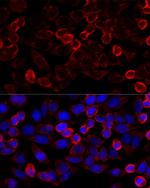 HDAC6 Antibody in Immunocytochemistry (ICC/IF)