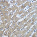 HDAC6 Antibody in Immunohistochemistry (Paraffin) (IHC (P))