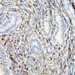 Vimentin Antibody in Immunohistochemistry (Paraffin) (IHC (P))