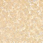 Ferritin Heavy Chain Antibody in Immunohistochemistry (Paraffin) (IHC (P))