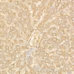 Ferritin Heavy Chain Antibody in Immunohistochemistry (Paraffin) (IHC (P))