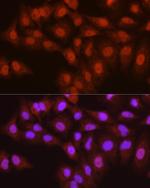 PYCARD Antibody in Immunocytochemistry (ICC/IF)