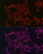 STAT3 Antibody in Immunocytochemistry (ICC/IF)