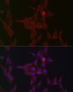 STAT3 Antibody in Immunocytochemistry (ICC/IF)