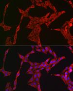 STAT3 Antibody in Immunocytochemistry (ICC/IF)