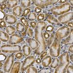 STAT3 Antibody in Immunohistochemistry (Paraffin) (IHC (P))