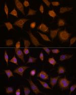 CDC20 Antibody in Immunocytochemistry (ICC/IF)