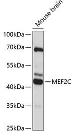 MEF2C Antibody in Western Blot (WB)