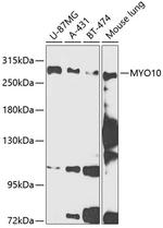 MYO10 Antibody in Western Blot (WB)