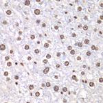 TOP1 Antibody in Immunohistochemistry (Paraffin) (IHC (P))