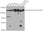 TOP1 Antibody in Western Blot (WB)