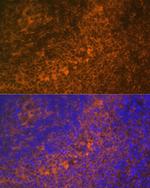 DR4 Antibody in Immunohistochemistry (Paraffin) (IHC (P))