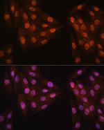 MAD2L2 Antibody in Immunocytochemistry (ICC/IF)