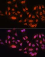 MAD2L2 Antibody in Immunocytochemistry (ICC/IF)