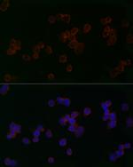 MFN2 Antibody in Immunocytochemistry (ICC/IF)