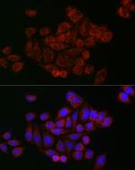 MFN2 Antibody in Immunocytochemistry (ICC/IF)