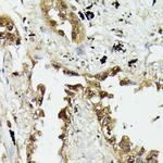 HSP70 Antibody in Immunohistochemistry (Paraffin) (IHC (P))