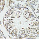 HSP70 Antibody in Immunohistochemistry (Paraffin) (IHC (P))