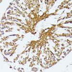 HSP70 Antibody in Immunohistochemistry (Paraffin) (IHC (P))