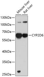 CYP2D6 Antibody in Western Blot (WB)