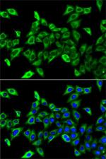 HADHA Antibody in Immunocytochemistry (ICC/IF)