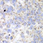 HADHA Antibody in Immunohistochemistry (Paraffin) (IHC (P))