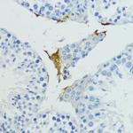 Plasma Kallikrein Antibody in Immunohistochemistry (Paraffin) (IHC (P))