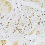 SLUG Antibody in Immunohistochemistry (Paraffin) (IHC (P))