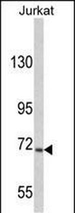 USP19 Antibody in Western Blot (WB)